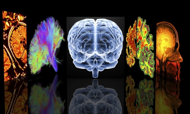 Hersencellen reageren veel sterker op beelden van lichamen dan op andere objecten